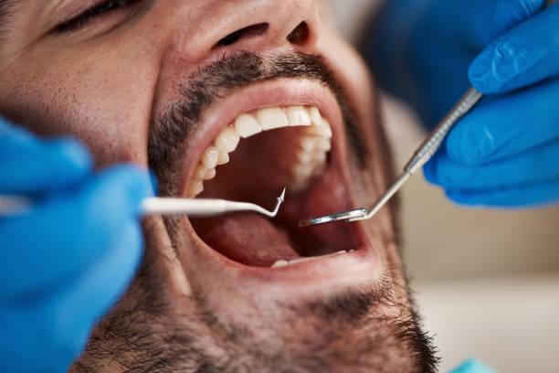 Best Emergency Broken Tooth Repair in Pantops, VA